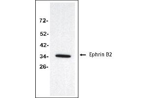 Antigen: Colo 205 cells lysate (Total protein per lane: 20 µg)  Primary Antibody: Anti-EFNB2 monoclonal (PA349-18. (Ephrin B2 anticorps  (Extracellular Domain))