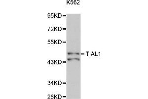 Western Blotting (WB) image for anti-TIA1 Cytotoxic Granule-Associated RNA Binding Protein-Like 1 (TIAL1) antibody (ABIN1877102) (TIAL1 anticorps)