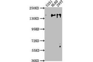 Western Blot Positive WB detected in: U251 whole cell lysate, HL60 whole cell lysate, 293T whole cell lysate All lanes: ADNP antibody at 1:2000 Secondary Goat polyclonal to rabbit IgG at 1/50000 dilution Predicted band size: 124 kDa Observed band size: 135 kDa