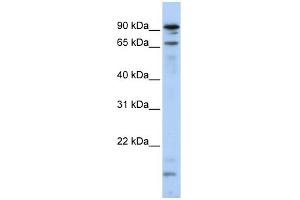 WB Suggested Anti-MSL2L1 Antibody Titration:  0. (MSL2 anticorps  (N-Term))