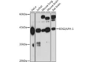 Western blot analysis of extracts of various cell lines, using EDG2/LPA-1 Rabbit mAb (ABIN7268334) at 1:1000 dilution. (LPAR1 anticorps)
