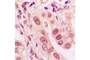 Immunohistochemistry (IHC) image for anti-Ubiquitin-Conjugating Enzyme E2Z (UBE2Z) antibody (ABIN7308474)