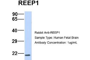 Host:  Rabbit  Target Name:  REEP1  Sample Type:  Human Fetal Brain  Antibody Dilution:  1. (Receptor Accessory Protein 1 anticorps  (C-Term))