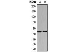 Western blot analysis of HARS expression in K562 (A), Raw264. (HARS1/Jo-1 anticorps  (C-Term))