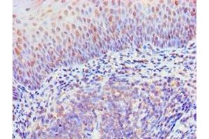 Immunohistochemistry of paraffin-embedded human tonsil tissue using ABIN7167479 at dilution of 1:100 (RIPK3 anticorps  (AA 1-120))