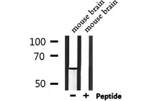 Western blot analysis of extracts from mouse brain, using Phospho-PAK1 (Thr212) Antibody.