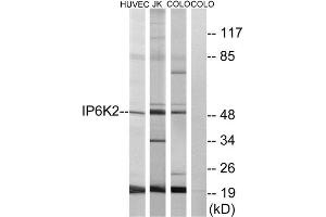 Western Blotting (WB) image for anti-Inositol Hexakisphosphate Kinase 2 (IP6K2) (Internal Region) antibody (ABIN1850059) (IP6K2 anticorps  (Internal Region))