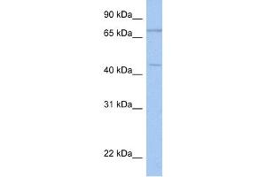 WB Suggested Anti-ISLR2 Antibody Titration:  0. (ISLR2 anticorps  (N-Term))