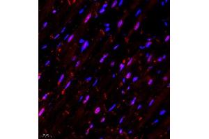 Immunofluorescence of paraffin embedded rat heart using NSD3 (ABIN7076233) at dilution of 1:650 (400x lens) (WHSC1L1 anticorps)