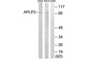 Western blot analysis of extracts from RAW264. (APLP2 anticorps  (AA 241-290))