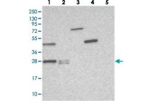 Western blot analysis of Lane 1: RT-4, Lane 2: U-251 MG, Lane 3: Human Plasma, Lane 4: Liver, Lane 5: Tonsil with THYN1 polyclonal antibody  at 1:250-1:500 dilution. (THYN1 anticorps)