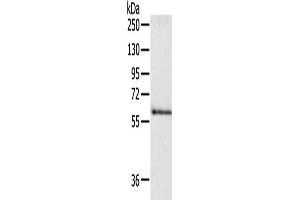 Gel: 8 % SDS-PAGE, Lysate: 40 μg, Lane: Human fetal brain tissue, Primary antibody: ABIN7190498(DPYSL5 Antibody) at dilution 1/250, Secondary antibody: Goat anti rabbit IgG at 1/8000 dilution, Exposure time: 30 seconds (DPYSL5 anticorps)