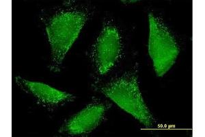 Immunofluorescence of purified MaxPab antibody to ACAA1 on HepG2 cell.