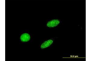 Immunofluorescence of monoclonal antibody to GCM1 on HeLa cell. (GCM1 anticorps  (AA 108-166))