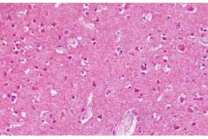 Anti-MGLUR2 / GLUR2 antibody IHC staining of human brain, cortex. (GRM2 anticorps  (N-Term))