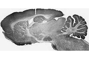 Whole adult rat brain immunohistochemistry.