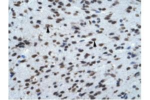 KCNK13 antibody was used for immunohistochemistry at a concentration of 4-8 ug/ml to stain Neural cells (arrows) in Human Brain. (KCNK13 anticorps  (C-Term))