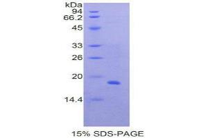 SDS-PAGE (SDS) image for Periostin (POSTN) (AA 500-630) protein (His tag) (ABIN2126262) (Periostin Protein (POSTN) (AA 500-630) (His tag))