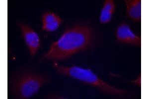 Image no. 2 for anti-Nitric Oxide Synthase 3 (Endothelial Cell) (NOS3) (pSer1177) antibody (ABIN319231)
