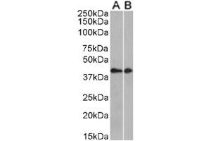 Western Blot using anti-CCRL2 antibody. (Recombinant CCRL2 anticorps  (AA 1-24))