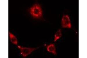ABIN6278631 staining Hela cells by IF/ICC. (RNF19A anticorps  (N-Term))