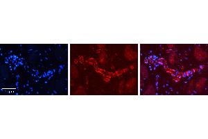 Rabbit Anti-PHF1 Antibody   Formalin Fixed Paraffin Embedded Tissue: Human heart Tissue Observed Staining: Cytoplasmic in endothelial cells in blood vessels Primary Antibody Concentration: 1:100 Other Working Concentrations: 1:600 Secondary Antibody: Donkey anti-Rabbit-Cy3 Secondary Antibody Concentration: 1:200 Magnification: 20X Exposure Time: 0. (PHF1 anticorps  (C-Term))