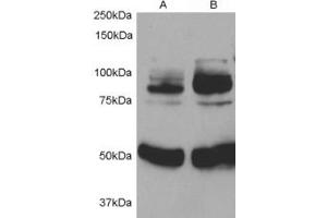 Western Blotting (WB) image for anti-Adaptor Protein, phosphotyrosine Interaction, PH Domain and Leucine Zipper Containing 1 (APPL1) (AA 145-158) antibody (ABIN293266)