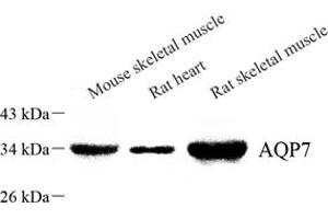 Western blot analysis of Aquaporin 7 (ABIN7073108) at dilution of 1: 800 (Aquaporin 7 anticorps)