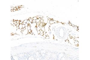 Immunohistochemistry (IHC) image for anti-CD36 (CD36) (AA 275-325) antibody (ABIN7795653)