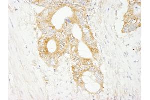 Immunohistochemistry (IHC) image for anti-Eukaryotic Translation Initiation Factor 3 Subunit J (EIF3S1) (AA 208-258) antibody (ABIN7448547) (EIF3S1 anticorps  (AA 208-258))