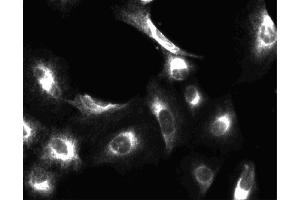 Immunofluorescent staining of A549 (ATCC CCL-185) cells. (PIK3CA anticorps  (AA 562-724))