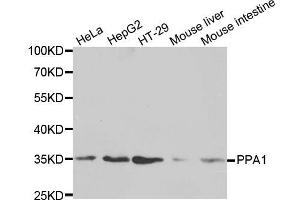 Western blot analysis of extracts of various cell lines, using PPA1 antibody (ABIN5971134) at 1/1000 dilution. (Pyrophosphatase (Inorganic) 1 (PPA1) anticorps)