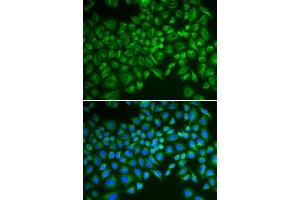 Immunofluorescence analysis of MCF-7 cells using SELE antibody. (Selectin E/CD62e anticorps)