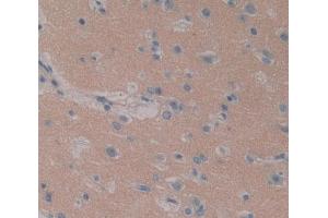 Used in DAB staining on fromalin fixed paraffin- embedded brain tissue