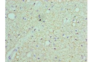 Immunohistochemistry of paraffin-embedded human brain tissue using ABIN7168870 at dilution of 1:100 (Septin 7 anticorps  (AA 308-437))