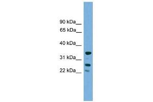 H1FOO antibody used at 1 ug/ml to detect target protein. (H1FOO anticorps  (Middle Region))