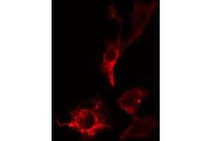 ABIN6275356 staining HepG2 cells by IF/ICC. (PITPNB anticorps  (C-Term))