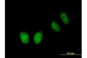 Immunofluorescence of purified MaxPab antibody to NUB1 on HeLa cell. (NUB1 anticorps  (AA 1-601))