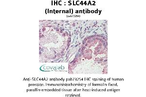 Image no. 2 for anti-Solute Carrier Family 44, Member 2 (SLC44A2) (Internal Region) antibody (ABIN1739381) (SLC44A2 anticorps  (Internal Region))