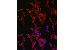 Immunofluorescence analysis of NIH/3T3 cells using FGFR3 Rabbit pAb (ABIN1679839, ABIN3015135, ABIN3015137 and ABIN6213838) at dilution of 1:100 (40x lens).