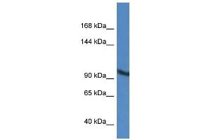 Western Blot showing ZMIZ2 antibody used at a concentration of 1 ug/ml against A549 Cell Lysate (ZMIZ2 anticorps  (Middle Region))