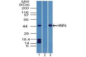 Image no. 2 for anti-One Cut Homeobox 1 (ONECUT1) (AA 420-470) antibody (ABIN960298) (ONECUT1 anticorps  (AA 420-470))