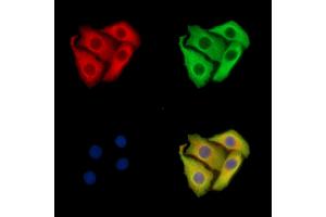 ABIN7095934 and ABIN7099996 staining Hela cells by IF/ICC. (INPP5F anticorps)