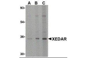 Western Blotting (WB) image for anti-Ectodysplasin A2 Receptor (EDA2R) antibody (ABIN2477154) (Ectodysplasin A2 Receptor anticorps)