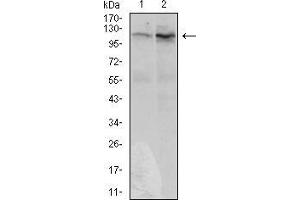 Western blot analysis using DIS3L2 mouse mAb against Hela (1) and HepG2 (2) cell lysate. (DIS3L2 anticorps  (AA 27-250))