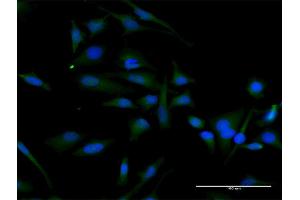 Immunofluorescence of purified MaxPab antibody to CCND2 on HeLa cell.