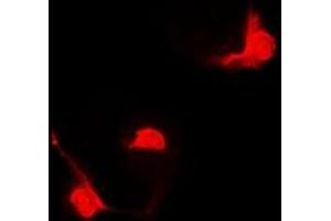 Immunofluorescent analysis of STAT5B staining in Hela cells. (STAT5B anticorps)