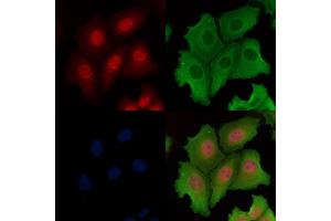ABIN6261878 and ABIN6266545 staining Hela cells by IF/ICC. (GANP anticorps  (C-Term))