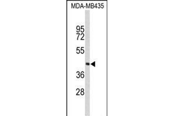 PHYH anticorps  (N-Term)