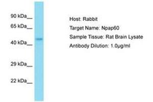 Image no. 1 for anti-Nucleoporin 50kDa (NUP50) (AA 21-70) antibody (ABIN6750333) (NUP50 anticorps  (AA 21-70))